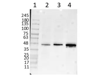 Anti-beta Amyloid antibody used in Western Blot (WB). GTX82974
