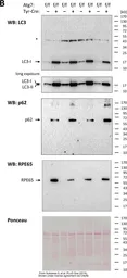 Anti-LC3B antibody used in Western Blot (WB). GTX82986