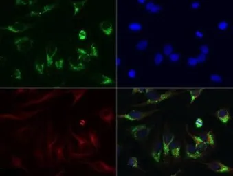 Anti-LC3B antibody used in Immunocytochemistry/ Immunofluorescence (ICC/IF). GTX82986