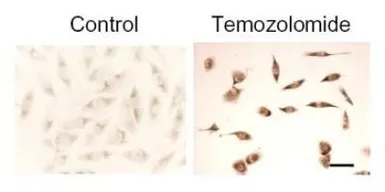 Anti-LC3B antibody used in Immunocytochemistry/ Immunofluorescence (ICC/IF). GTX82986