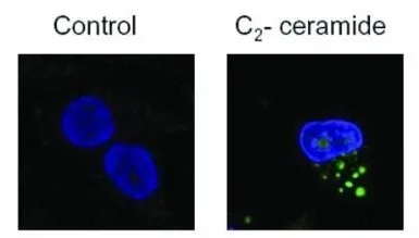 Anti-LC3B antibody used in Immunocytochemistry/ Immunofluorescence (ICC/IF). GTX82986