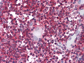 Anti-CD3 zeta antibody [4B10] used in IHC (Paraffin sections) (IHC-P). GTX83004