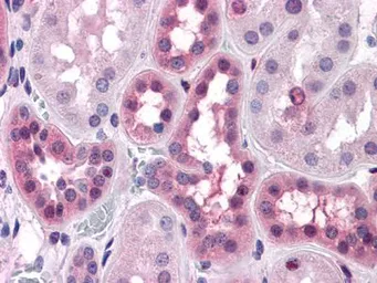 Anti-ERK1/2 antibody [3F8] used in IHC (Paraffin sections) (IHC-P). GTX83006