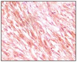 Anti-c-Kit antibody [8D7] used in IHC (Paraffin sections) (IHC-P). GTX83074