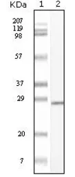 Anti-c-Kit antibody [8D7] used in Western Blot (WB). GTX83074