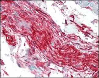 Anti-S100A10 antibody [4E7E10] used in IHC (Paraffin sections) (IHC-P). GTX83075