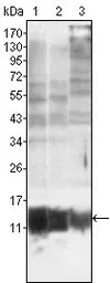 Anti-S100A10 antibody [4E7E10] used in Western Blot (WB). GTX83075
