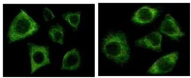 Anti-pan Cytokeratin antibody [7H8C4] used in Immunocytochemistry/ Immunofluorescence (ICC/IF). GTX83079