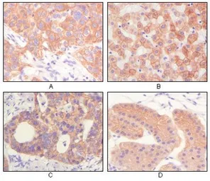 Anti-pan Cytokeratin antibody [7H8C4] used in IHC (Paraffin sections) (IHC-P). GTX83079