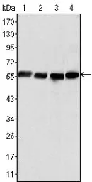 Anti-Vimentin antibody [4F2E9] used in Western Blot (WB). GTX83095