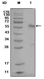 Anti-Estrogen Receptor alpha antibody [2G112B3] used in Western Blot (WB). GTX83112