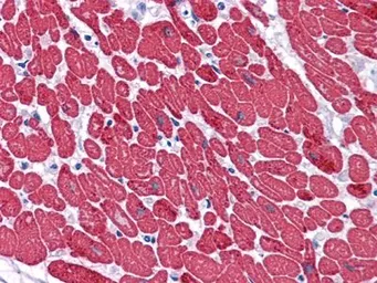 Anti-Myosin Light Chain 3 antibody [3F8] used in IHC (Paraffin sections) (IHC-P). GTX83123