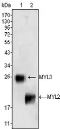 Anti-Myosin Light Chain 2 (MLC-2v) antibody [7C9] used in Western Blot (WB). GTX83133