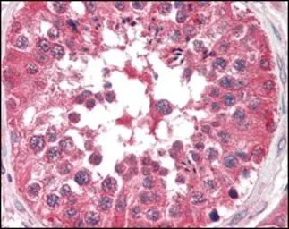 Anti-B-Raf antibody [1H12] used in IHC (Paraffin sections) (IHC-P). GTX83134