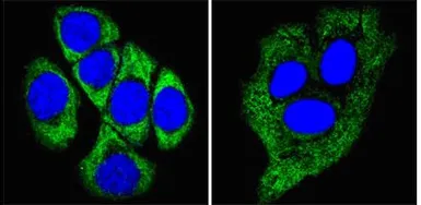 Anti-Cytokeratin 8 antibody [8A5D12] used in Immunocytochemistry/ Immunofluorescence (ICC/IF). GTX83140