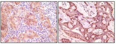 Anti-gamma Synuclein antibody [1H10D2] used in IHC (Paraffin sections) (IHC-P). GTX83156