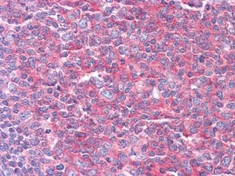 Anti-Lysyl-tRNA synthetase antibody [8G12C1] used in IHC (Paraffin sections) (IHC-P). GTX83186