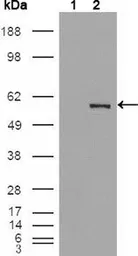 Anti-PEA3 antibody [1A2G3] used in Western Blot (WB). GTX83188