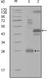 Anti-MAP4K4 antibody [4H9E7] used in Western Blot (WB). GTX83190