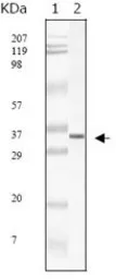 Anti-SARS-CoV M antibody [2H2C4] used in Western Blot (WB). GTX83199