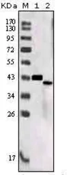 Anti-SorLA antibody [7D7B11] used in Western Blot (WB). GTX83205