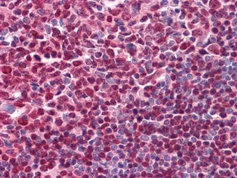 CD20 antibody [3E9D3C1G3]