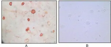 Anti-KSHV K8 alpha antibody [8C12G10G1] used in Immunocytochemistry/ Immunofluorescence (ICC/IF). GTX83237