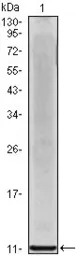 Anti-CXCL8 / IL8 antibody [3E4D8] used in Western Blot (WB). GTX83239