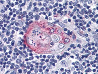 Anti-AKT2 antibody [1B6] used in IHC (Paraffin sections) (IHC-P). GTX83257