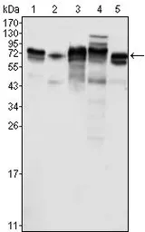 Anti-LYRIC antibody [2F11C3] used in Western Blot (WB). GTX83259