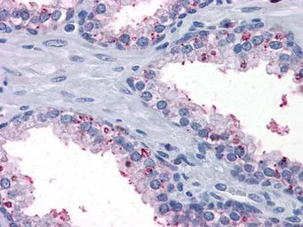 Anti-BDH1 antibody [1A5] used in IHC (Paraffin sections) (IHC-P). GTX83270
