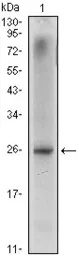Anti-Nkx3.1 antibody [4H4] used in Western Blot (WB). GTX83288