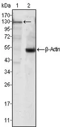 Anti-JAK3 antibody [5H2] used in Western Blot (WB). GTX83303