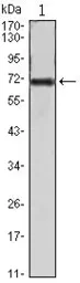 Anti-FAK antibody [10H7E9] used in Western Blot (WB). GTX83323