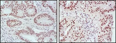Anti-MLH1 antibody [4C9C7] used in IHC (Paraffin sections) (IHC-P). GTX83336
