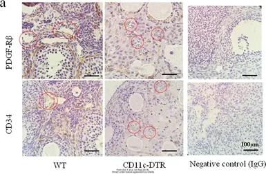 Anti-PDGF Receptor beta antibody [1A2] used in IHC (Paraffin sections) (IHC-P). GTX83371