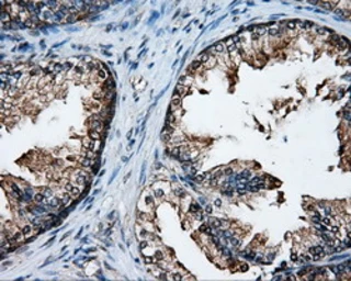 Anti-XRCC1 antibody [2D8] used in IHC (Paraffin sections) (IHC-P). GTX83411