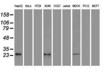 Anti-VEGFA antibody [4G3] used in Western Blot (WB). GTX83425