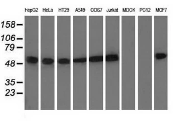 Anti-alpha Tubulin 8 antibody [2C2] used in Western Blot (WB). GTX83461