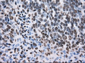Anti-TTLL12 antibody [4B2] used in IHC (Paraffin sections) (IHC-P). GTX83473
