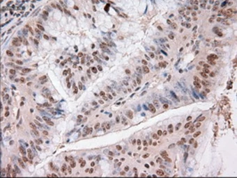 Anti-TIF1 gamma antibody [9D4] used in IHC (Paraffin sections) (IHC-P). GTX83492