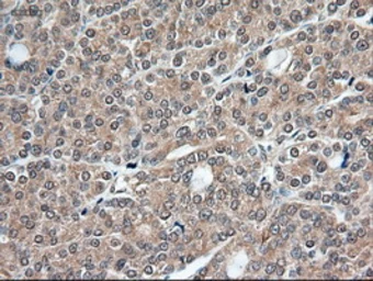 Anti-TIF1 gamma antibody [9D4] used in IHC (Paraffin sections) (IHC-P). GTX83492