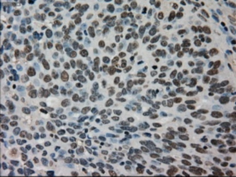 Anti-TMEM100 antibody [2D3] used in IHC (Paraffin sections) (IHC-P). GTX83509