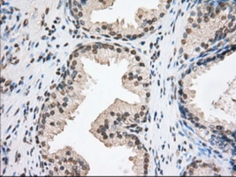 Anti-TACC3 antibody [8F6] used in IHC (Paraffin sections) (IHC-P). GTX83534