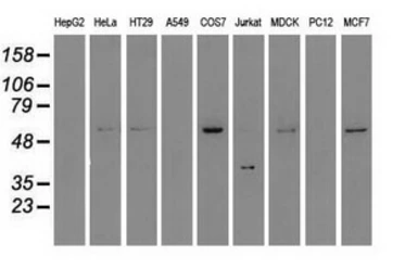 Anti-STK3 antibody [4G10] used in Western Blot (WB). GTX83546