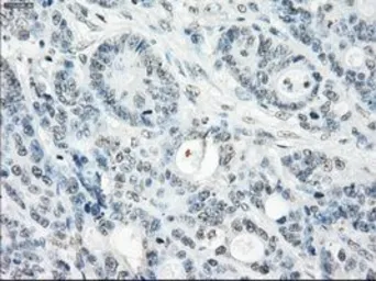 Anti-SSX2 antibody [4A11] used in IHC (Paraffin sections) (IHC-P). GTX83554