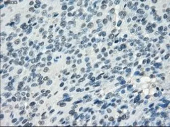 Anti-SSX2 antibody [4A11] used in IHC (Paraffin sections) (IHC-P). GTX83554