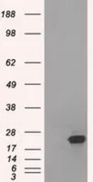 Anti-SSX2 antibody [4A11] used in Western Blot (WB). GTX83554