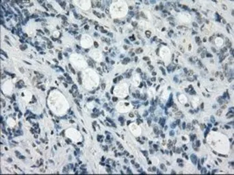 Anti-SSX2 antibody [4D10] used in IHC (Paraffin sections) (IHC-P). GTX83555