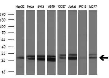 Anti-SSX2 antibody [4D10] used in Western Blot (WB). GTX83555